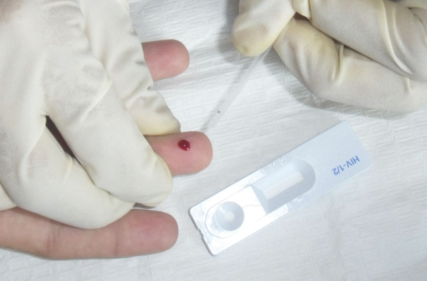 Los test de detección rápida forman parte de la campaña de respuesta al VIH/Sida // Foto Marlene Herrera Matos 