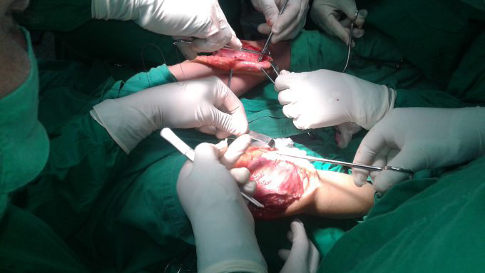 El niño fue operado de luxación congénita de rótula bilateral // Foto Cortesía de la familia