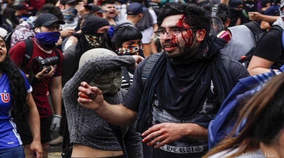 Manifestante herido en la cabeza por una bomba lacrimógena (Santiago de Chile, 20 de octubre 2019). Foto: Instagram/@Diaz_de_Fotografias.