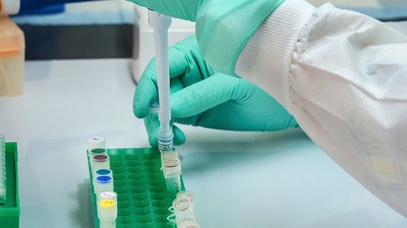 Especialistas de la Universidad de Pittsburgh, en Estados Unidos, encontraron una biomolécula que “neutraliza completa y específicamente” el coronavirus.// Foto RT