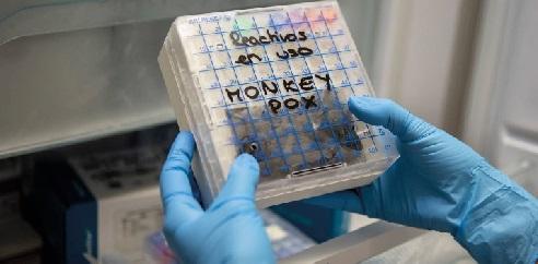 Muestras sospechosas de viruela del mono en un laboratorio de microbiología. Foto: Pablo Blázquez Dominguez/Bloomberglinea